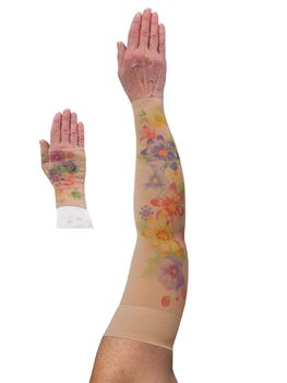 LympheDIVAS Dahlia Lymphoedema Sleeve and Gauntlet Set