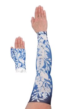 LympheDIVAS Anastasia Lymphoedema Sleeve and Gauntlet Set